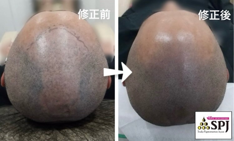 ヘアアートメイクは失敗しても直すことができます。